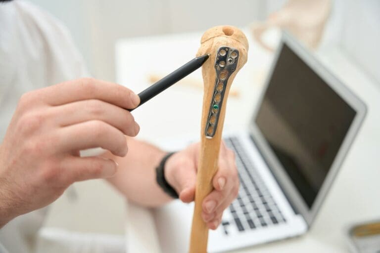 Un doctor ortoped care tine o replica a unui os explicând anatomia