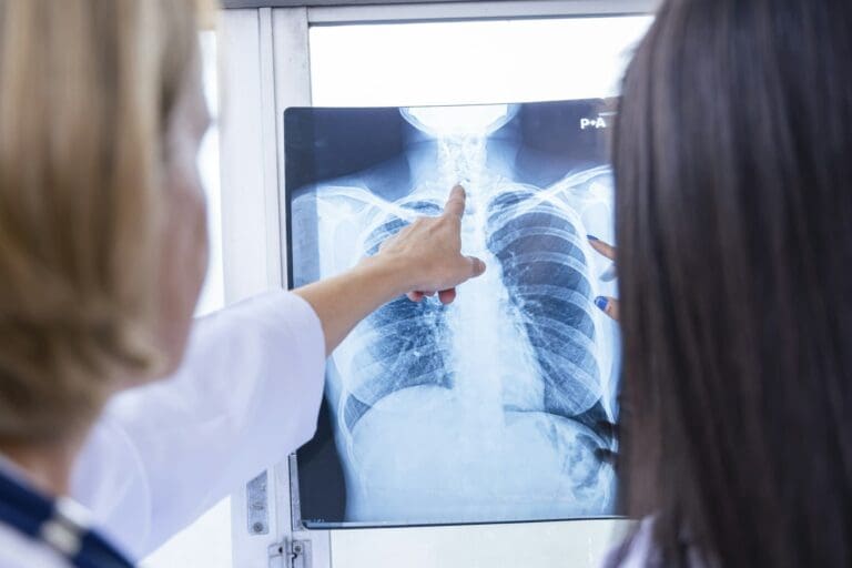 Doctor explicând rezultatele unei radiografii